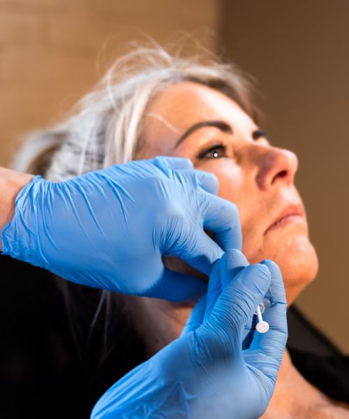 Hangende mondhoeken liften Dokterfinn