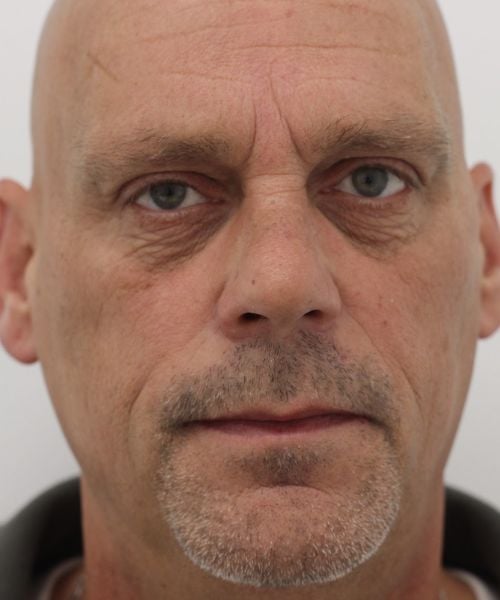 Slapen laten opvullen met fillers