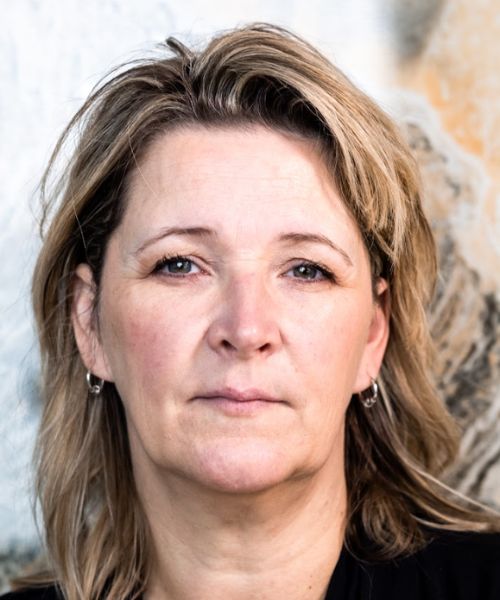 Voorhoofd rimpels verminderen met botulinetoxine bij Dokterfinn